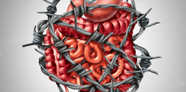 hội chứng ruột kích thích