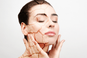 chăm sóc da khô với nghệ và mật ong