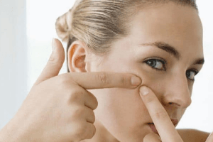 cách trị mụn cho mẹ bầumẹ sữa sau sinh