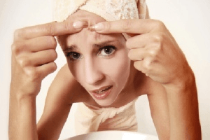 cách trị mụn trứng cá tại nhà