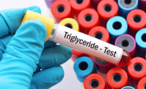 Triglyceride