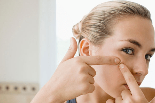 trị mụn trứng cá