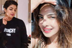 đắp mặt nạ khoai tây