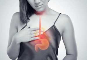 trào ngược dạ dày