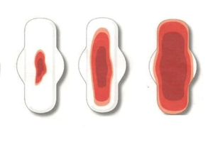 rong kinh có nên uống bột nghệ đen