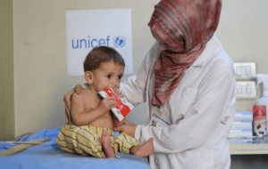 trẻ bị cam tích