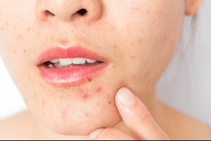 uống bột nghệ đỏ nóng hơn tinh bột nghệ vàng