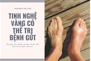 tinh bột nghệ vàng có thể điều trị bệnh gút