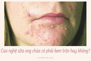 cao nghệ sữa ong chúa có phải kem trộn