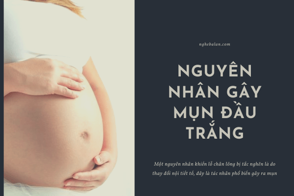 nguyên nhân gây mụn đầu trắng